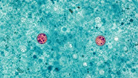 Two sharply stained Cyclospora oocysts among a wider field of pale oocysts in a blue-green microscopic specimen
